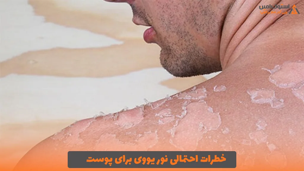 خطرات احتمالی نور یووی برای پوست